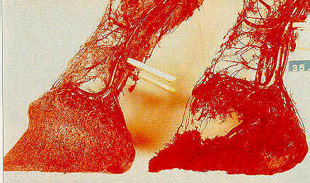 plastination