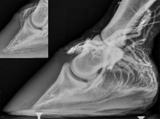 veinogramme
