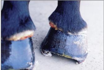 avulsion